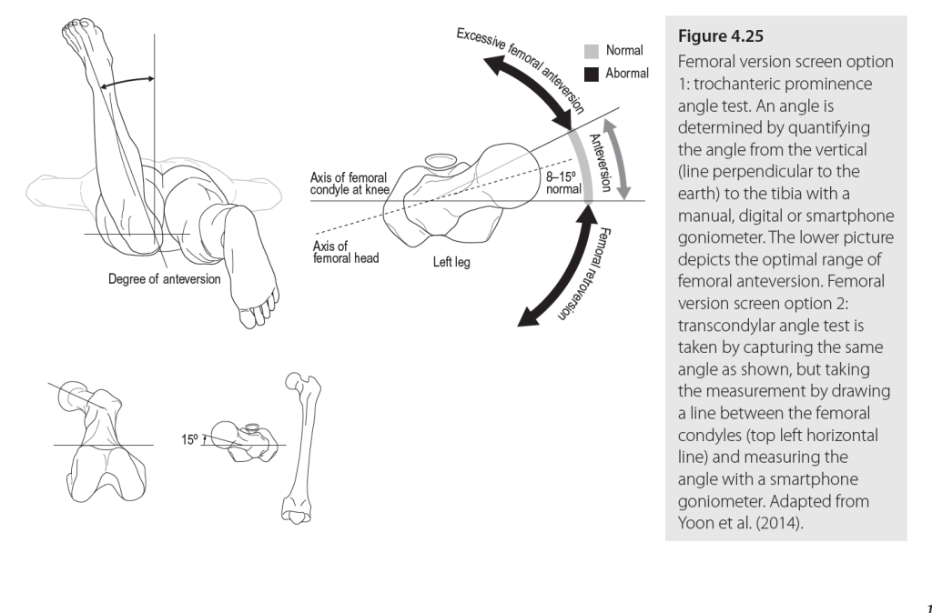 Dr. Ginger Garner, Femoral Version Screen